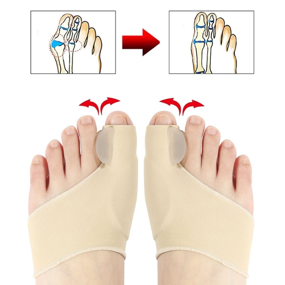 Bunion Corrector, Foot, skin,  Bunion Corrector, Toe Corrector